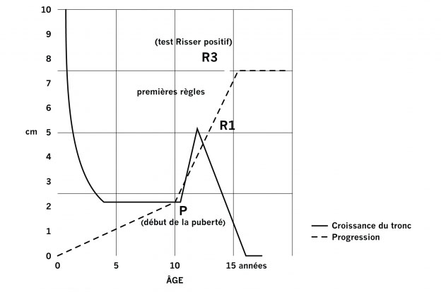 Diagramme de Duval-Beaupère et al.